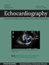 Echocardiography-a Journal Of Cardiovascular Ultrasound And Allied Techniques